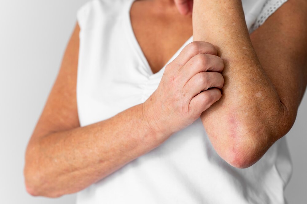 Skin allergy reaction test on arm